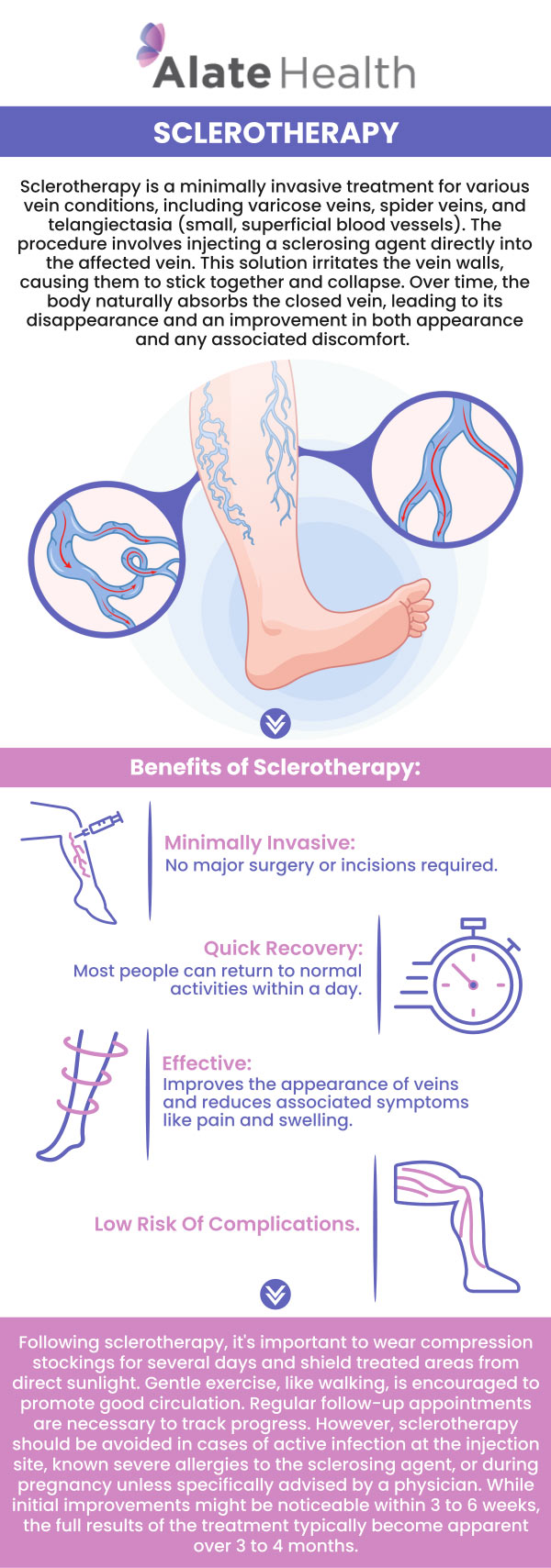Sclerotherapy provides a minimally invasive solution to this common concern. The results from sclerotherapy are generally long-lasting and considered permanent for the veins that are effectively treated. Once a vein has been sclerosed, it does not usually reopen or become visible again helping patients enjoy long-term relief from varicose or spider veins. Andrew Doe, MD, provide sclerotherapy at Alate Health Interventional Radiology Clinic. For more details, contact us today or book an appointment online. We have convenient locations to serve you in Hermann Drive Houston, TX, and Gulf Freeway Houston, TX.