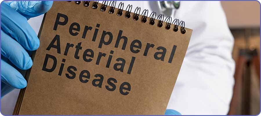 What Is Peripheral Artery Disease (PAD) and How Can It Be Treated? | Alate Health Interventional Radiology Clinic in Hermann Drive Houston TX, and Gulf Freeway Houston TX
