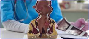 Hemorrhoid Artery Embolization (HAE) Specialist Near Me in Houston, TX