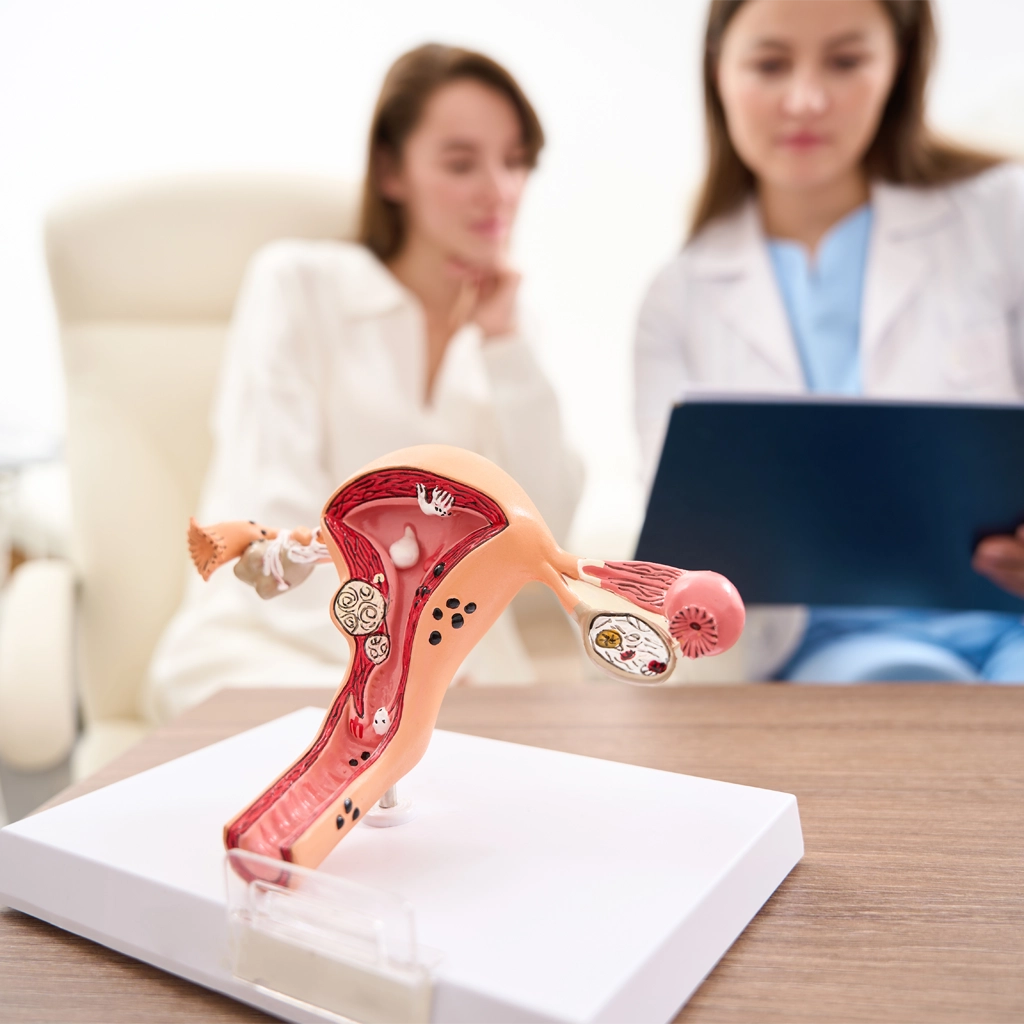 Uterine Fibroid Embolization (UFE) Treatment