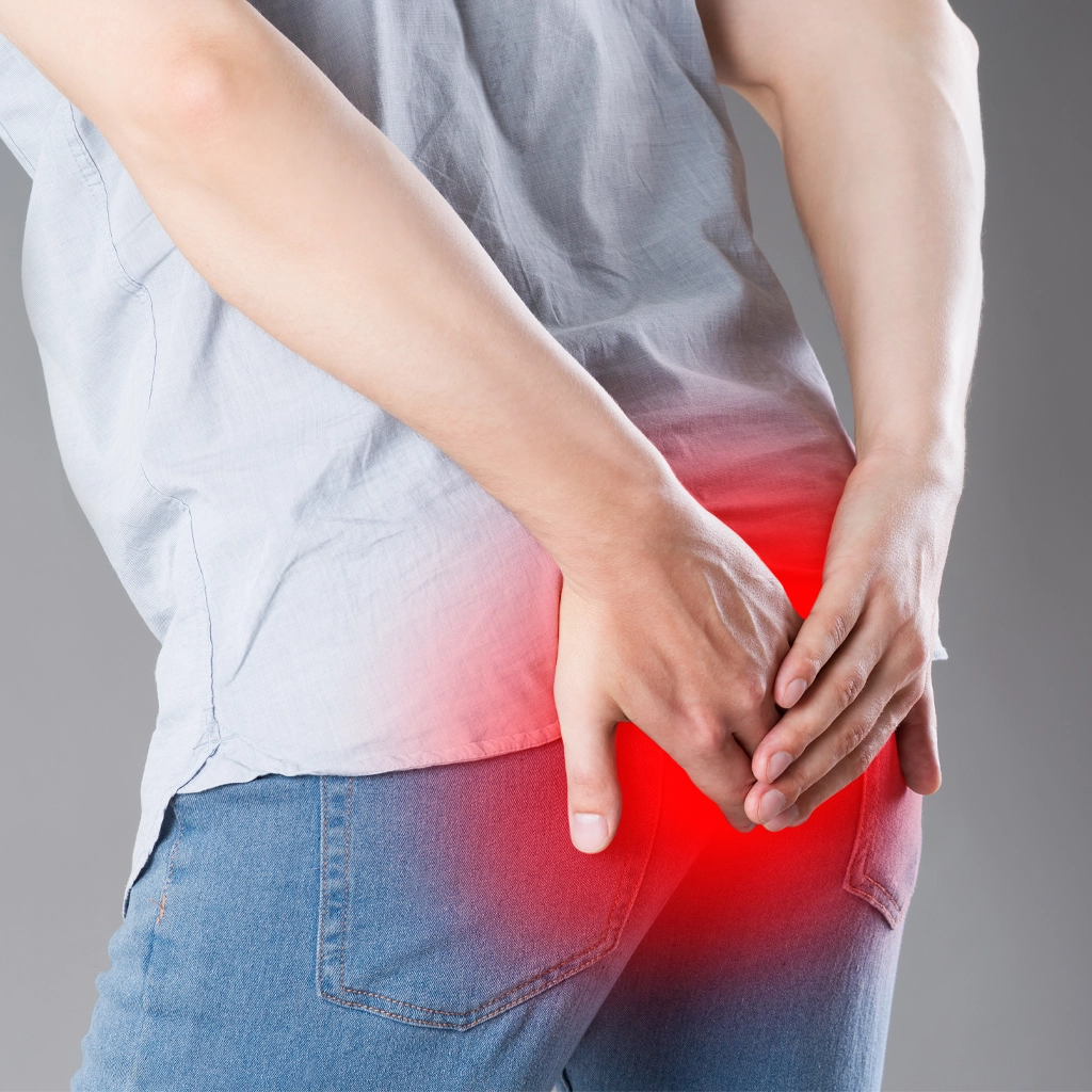 HAE for Chronic Hemorrhoids